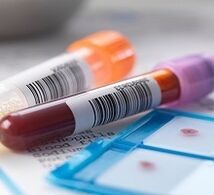 Laboratorijska dijagnoza prostatitisa