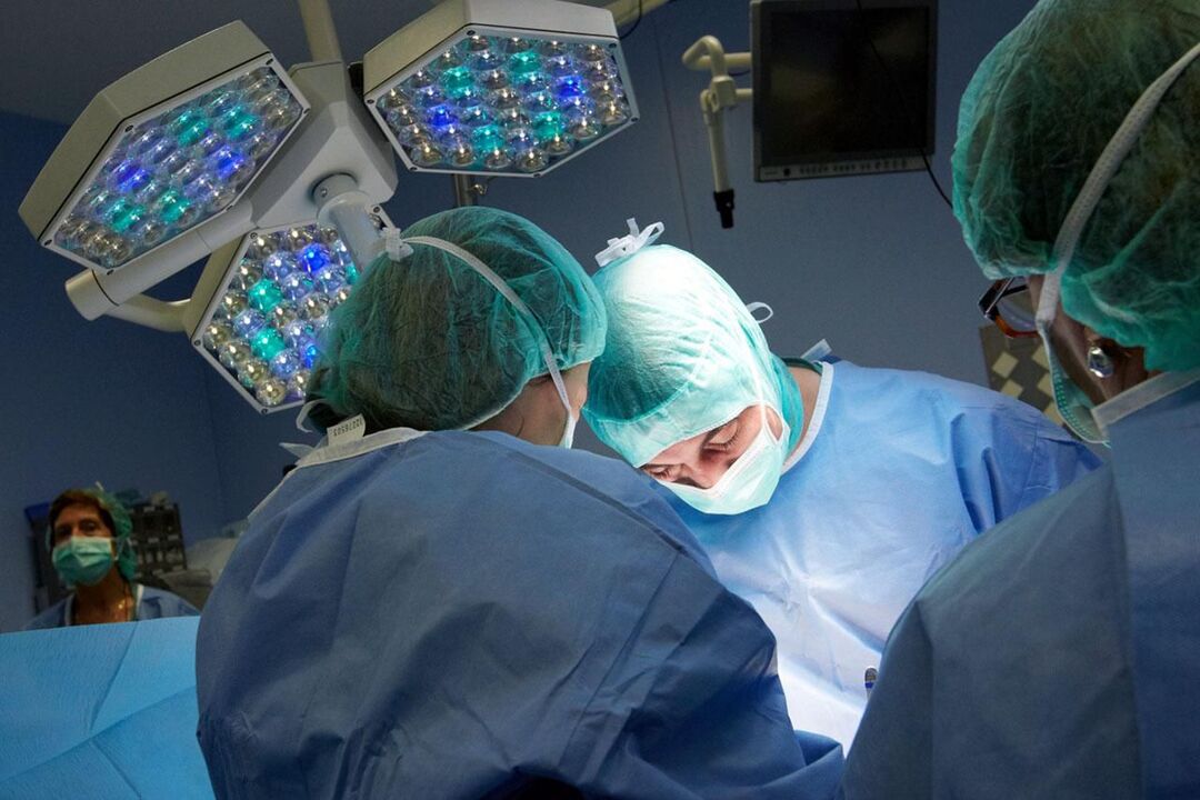 Operacija u kroničnom prostatitisu