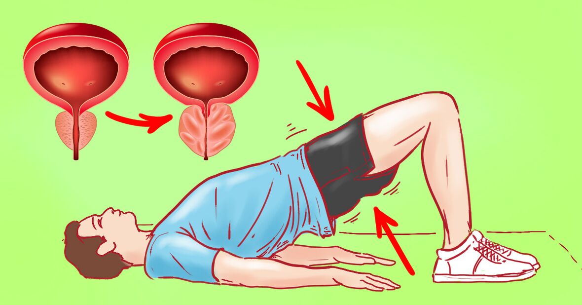 Terapijske vježbe za kronični prostatitis